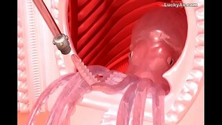 ��� ຕີນແຜນການ